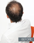 Kamitek Hair microfibers on man with baldness