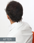 Kamitek Hair Microfibers Result After on man with baldness with thicker, fuller hair