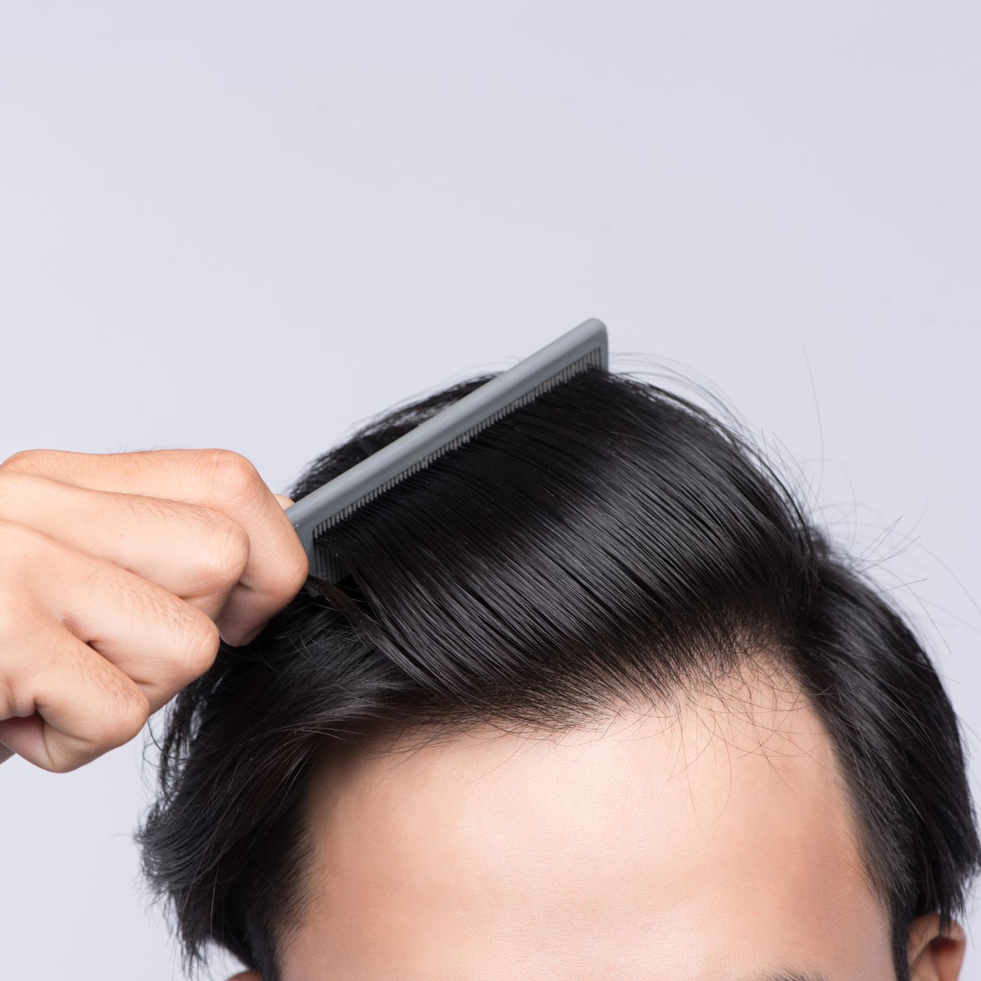 Dry Dandruff and Hair thinning in men