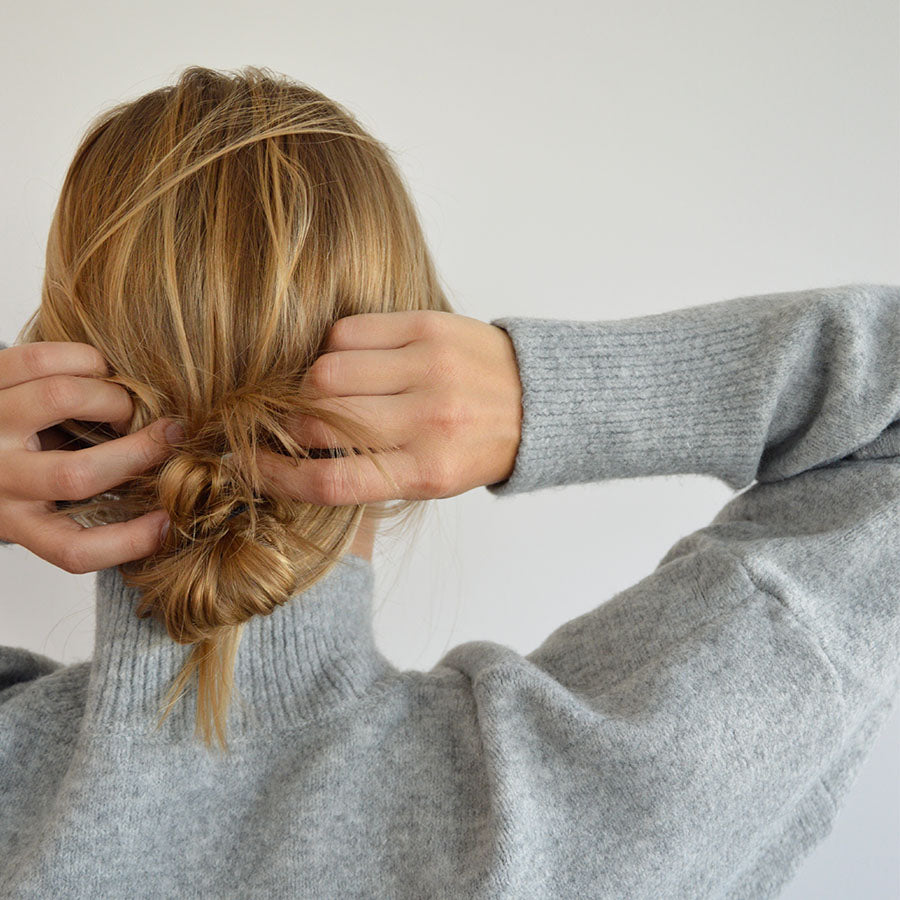 Woman with Oily Hair and scalp 