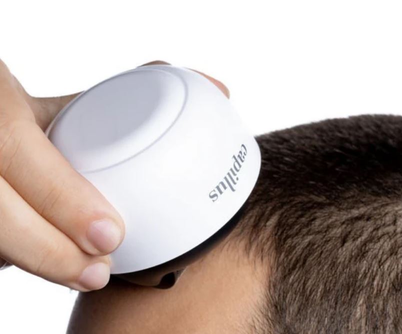 Capillus Dermaroller microneedling for hair loss in canada
